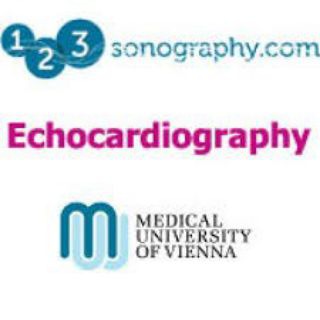 123 sonography-ECHO